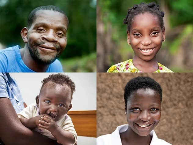 Donate to Operation Smile